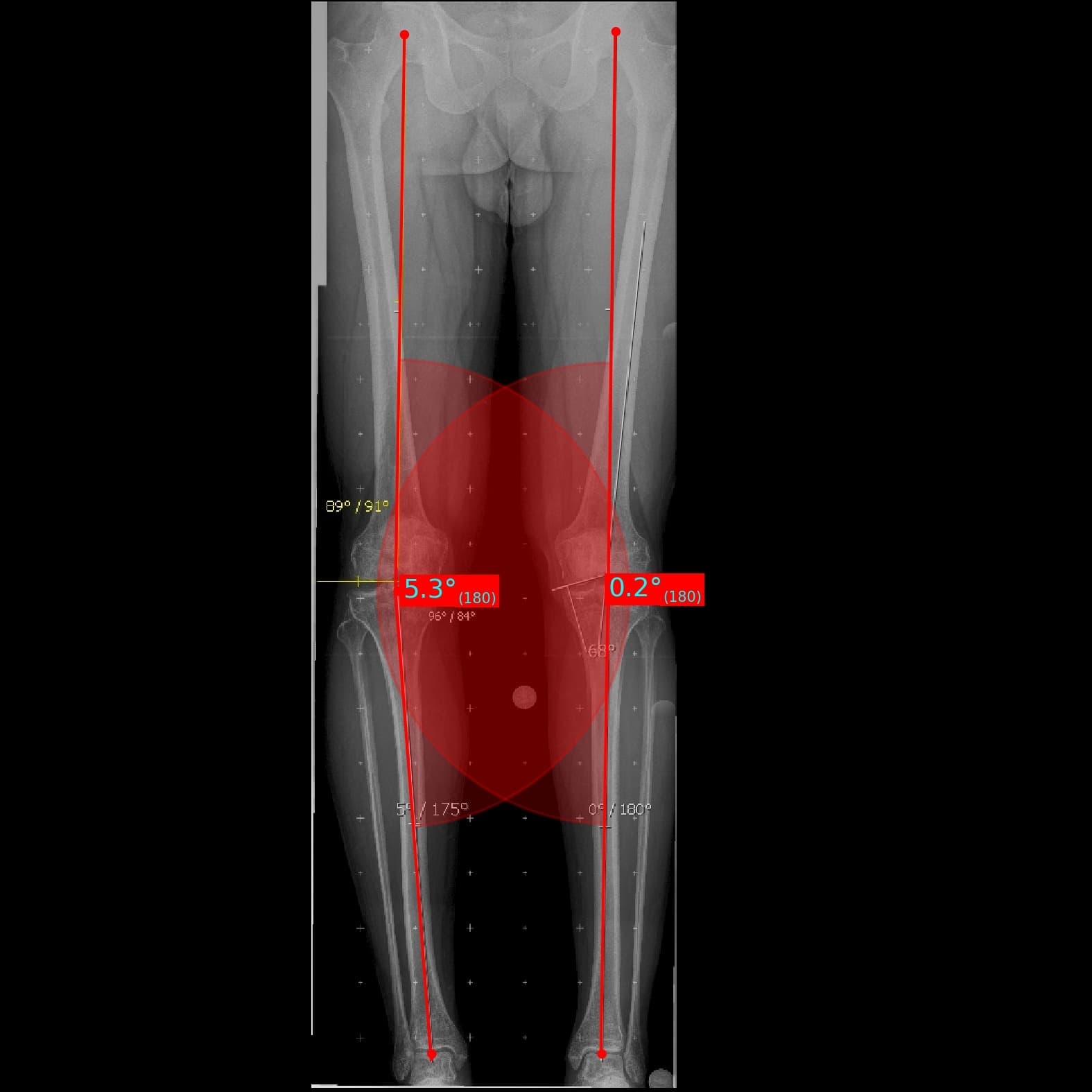 Knee Pain Treatment